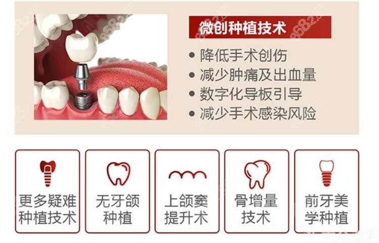 正睿口腔种牙技术