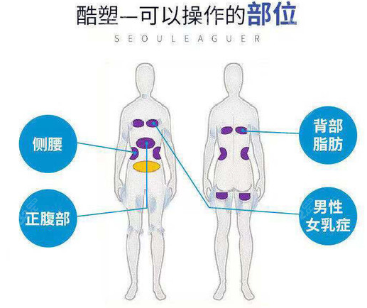 酷塑冷冻溶脂可以做哪些部位