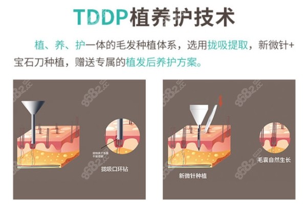 上海四大植发机构有哪四家