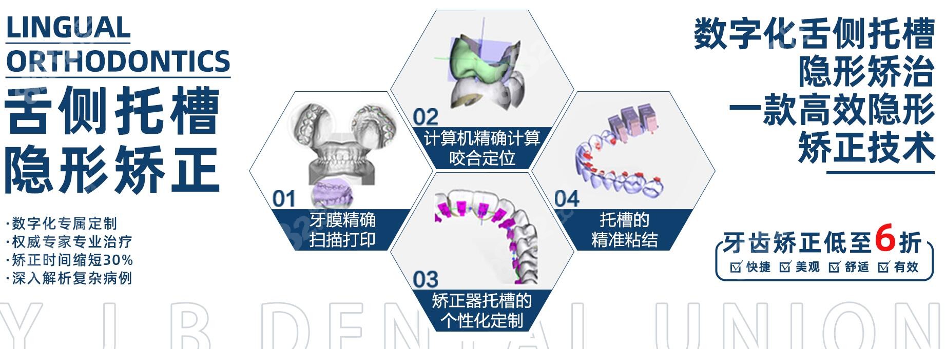 优佳贝口腔的舌侧技术