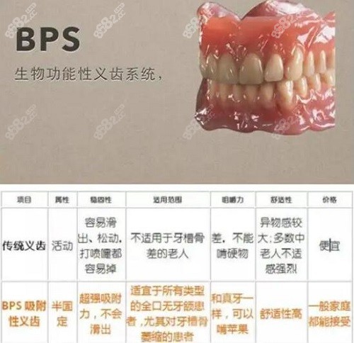 bps吸附性义齿和普通义齿