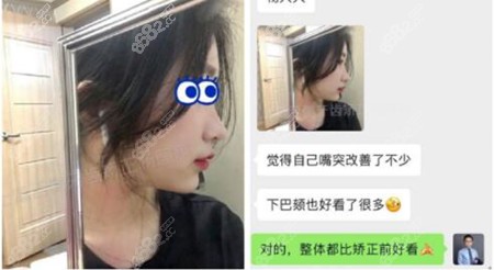 上海正畸杨国平好评 上海正畸杨国平好评