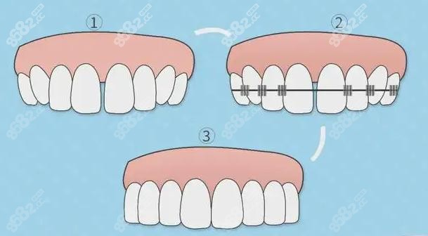 恩施恩东口腔做牙齿矫正怎么样