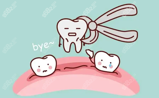 福州美可普口腔拔牙价格