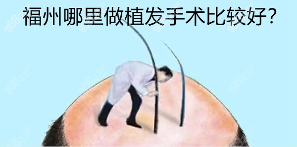 福州哪里做植发手术比较好？往下看