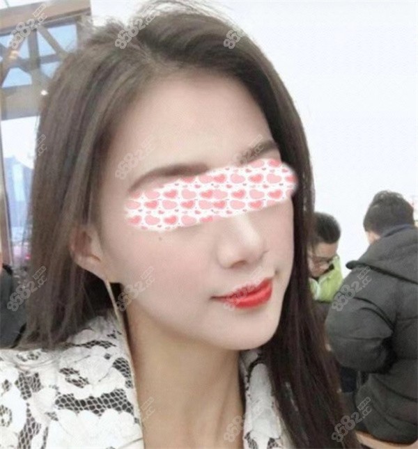 南京吳國平下頜角手術(shù)怎么樣？