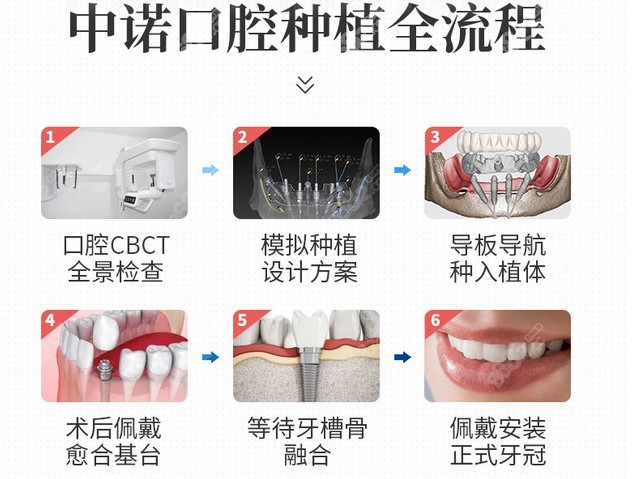 中诺口腔数字化种植牙流程