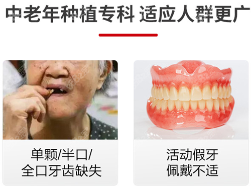 北京美冠塔口腔种植牙