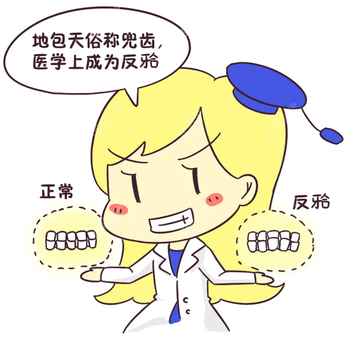 地包天图片