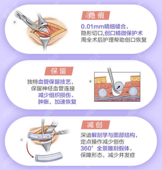 长沙美莱隆鼻优势