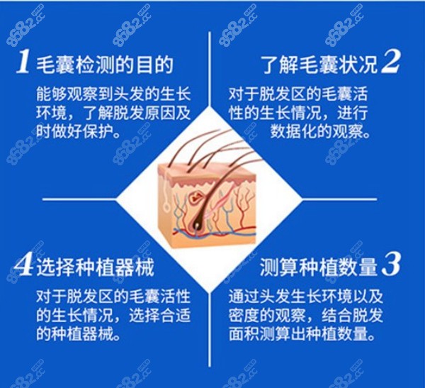 毛囊检测的好处