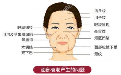 面部衰老产生的问题