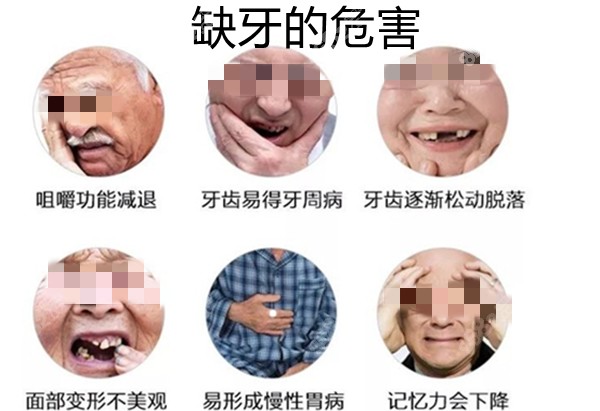 缺牙的危害图