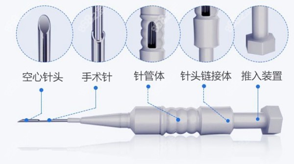 西安未央微针植发技术多少钱