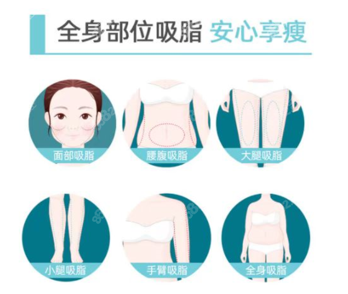 淄博美冠臣可以做的抽脂部位