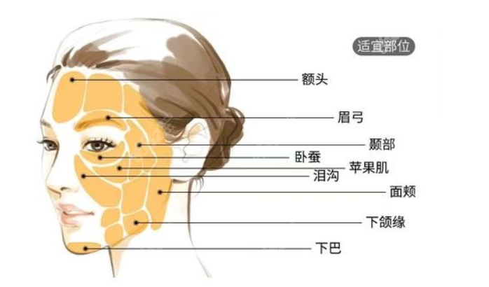 合肥壹加壹可以做的脂肪填充部位