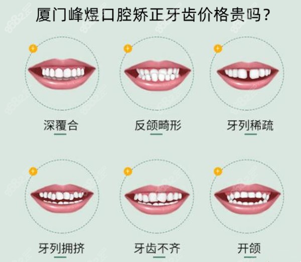 厦门峰煜口腔矫正牙齿价格贵吗？以思明区万象城店为例