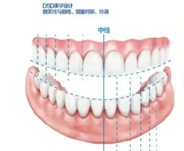 <!--<i data=20240705-sp></i>-->美莱口腔牙齿矫正融合美学