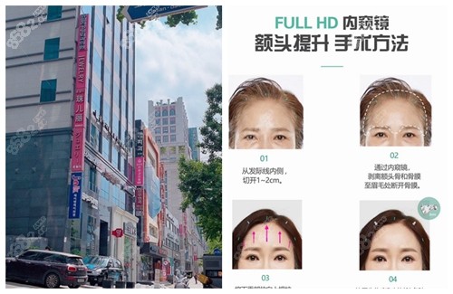 珠儿丽医院做额头缩小手术技术特色