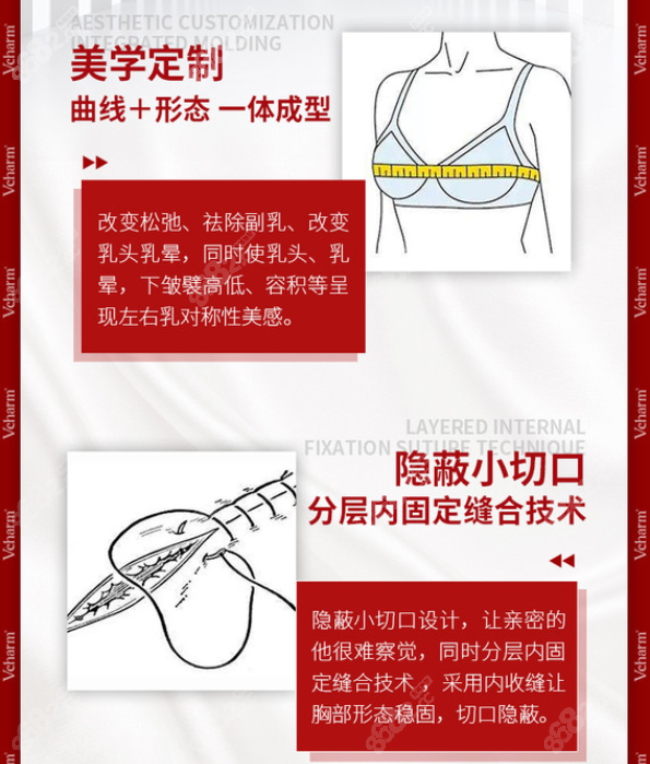 牙祖蒙是重庆专攻隆胸技术的医生