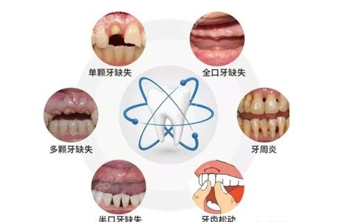 西安美奥口腔可以诊疗多种牙齿问题