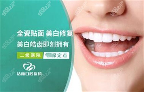 大连洁雅口腔贴面