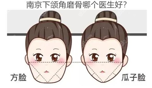 南京做下頜角哪個(gè)醫(yī)生好？