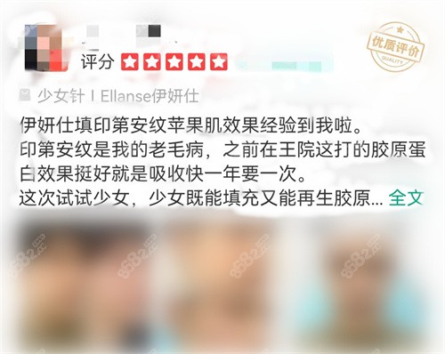 伊妍仕少女针注射有做过的吗，评价怎么样？