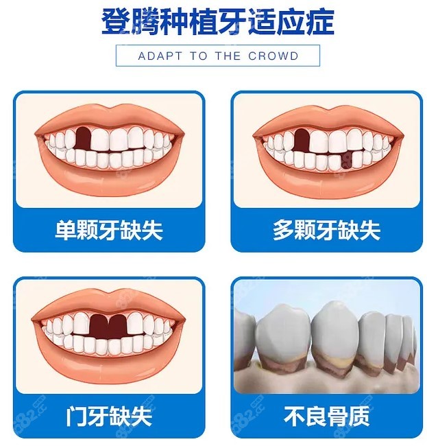疼痛种植牙适应症