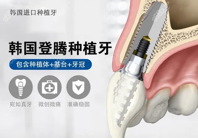 韩国登腾种植牙