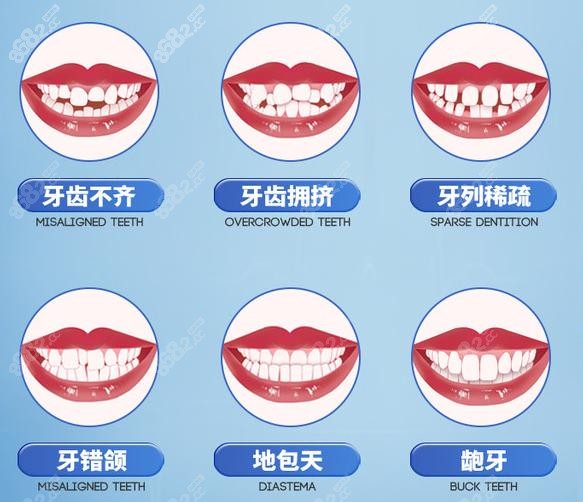 宁波恒美口腔牙齿矫正适应人群