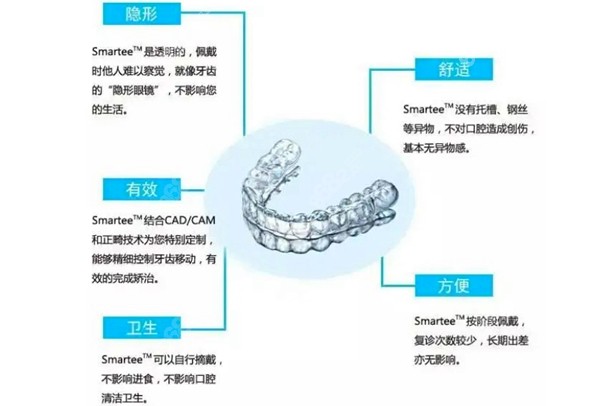国产正雅隐形矫正的优势