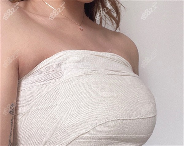 变性手术隆胸图片