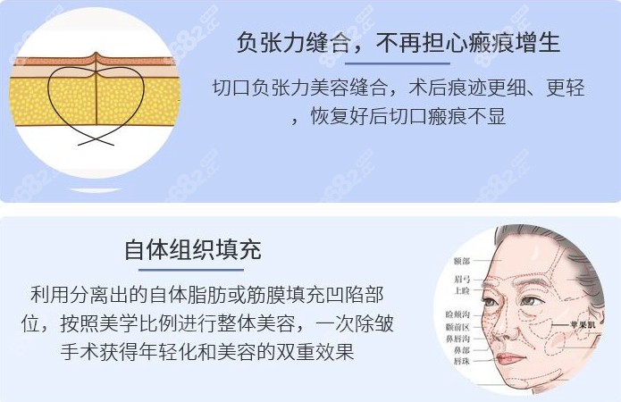 西安王志军医生拉皮技术就是好