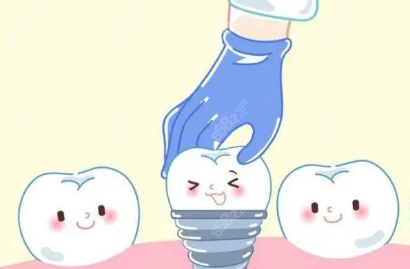 潛江種植牙哪家好