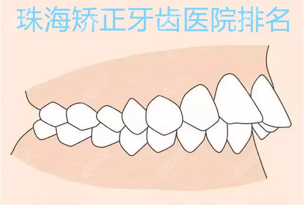 珠海矫正牙齿医院排名