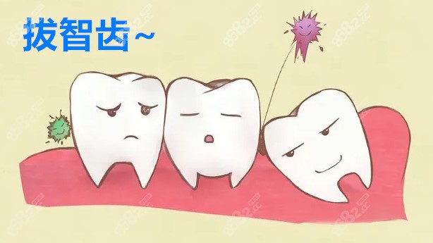廣州拔智齒價格