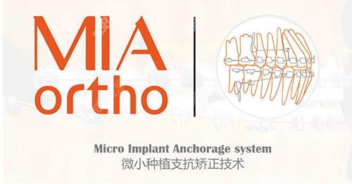 北京庆北米亚口腔MIA微种植支抗颜面矫正技术