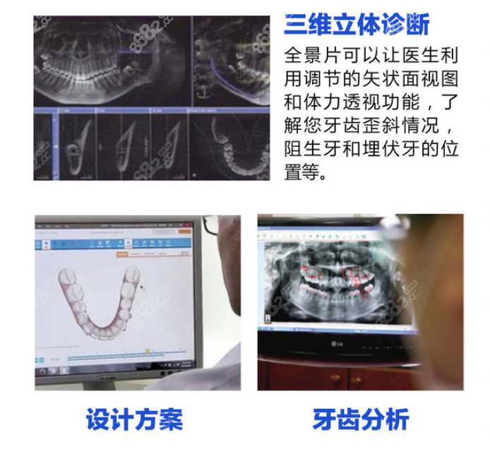 广州中家医口腔牙齿矫正怎么样