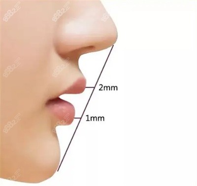 曹海峰医生在隆鼻方面的技术优势2