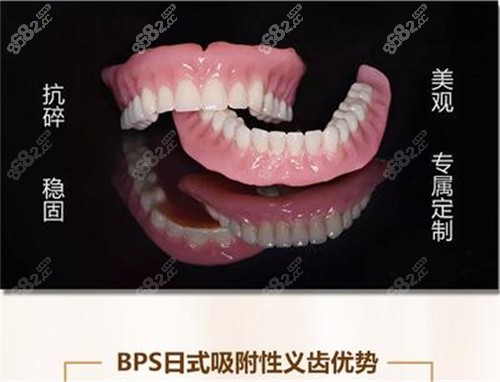 BPS功能吸附性义齿图