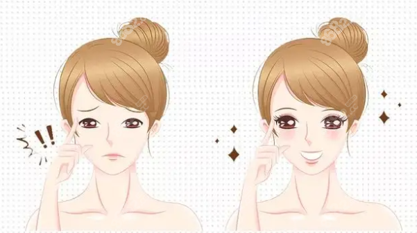 济南韩氏双眼皮修复的价格