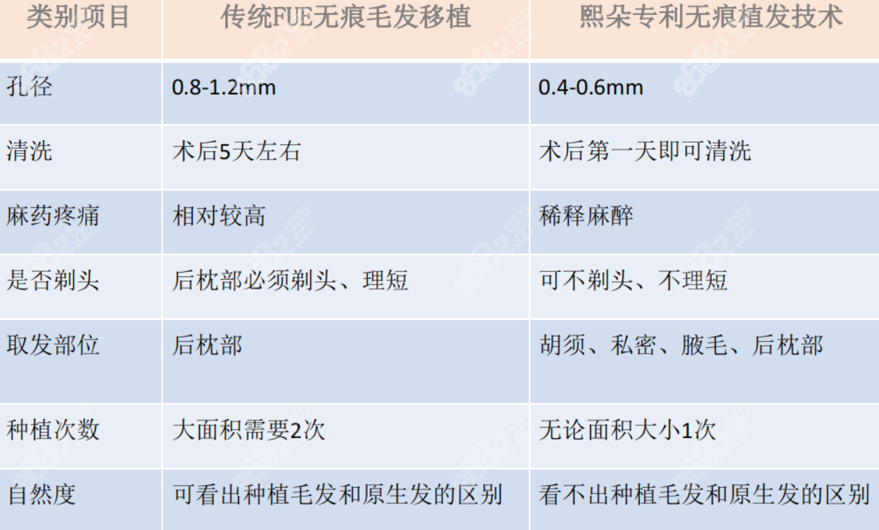 熙朵的无痕植发技术优势