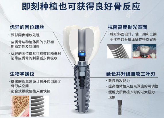 成都极光口腔即刻种植