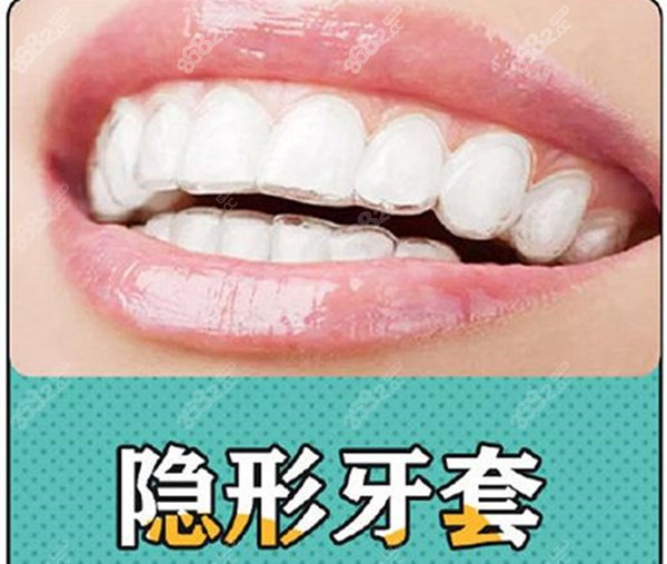 隐形矫正牙套收费标准