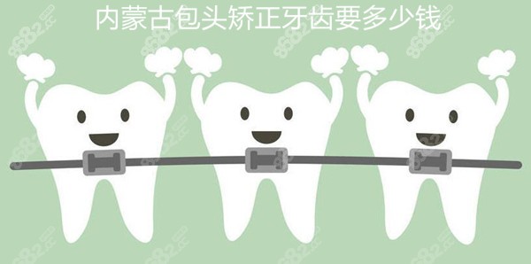 包头牙齿矫正多少钱