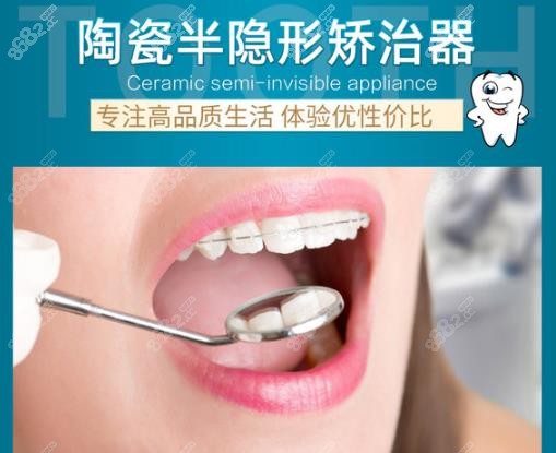 陶瓷半隐形正畸费用