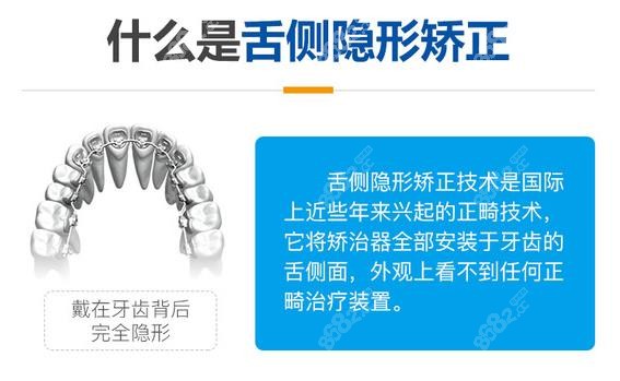 舌侧隐形矫正的价格