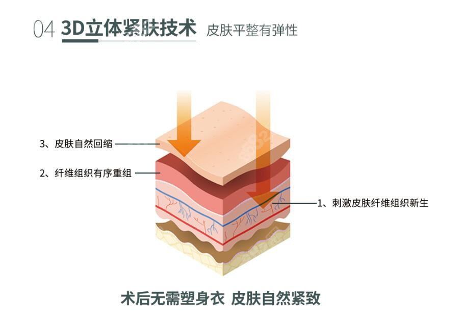 土麦森吸脂正规吗?