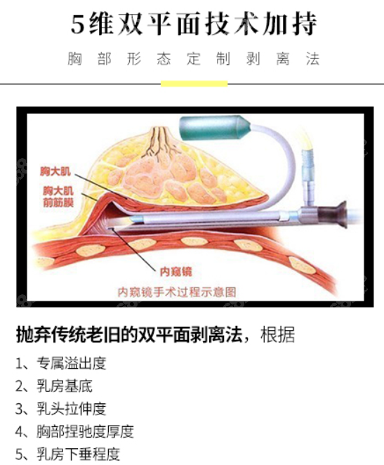 五维双平面技术